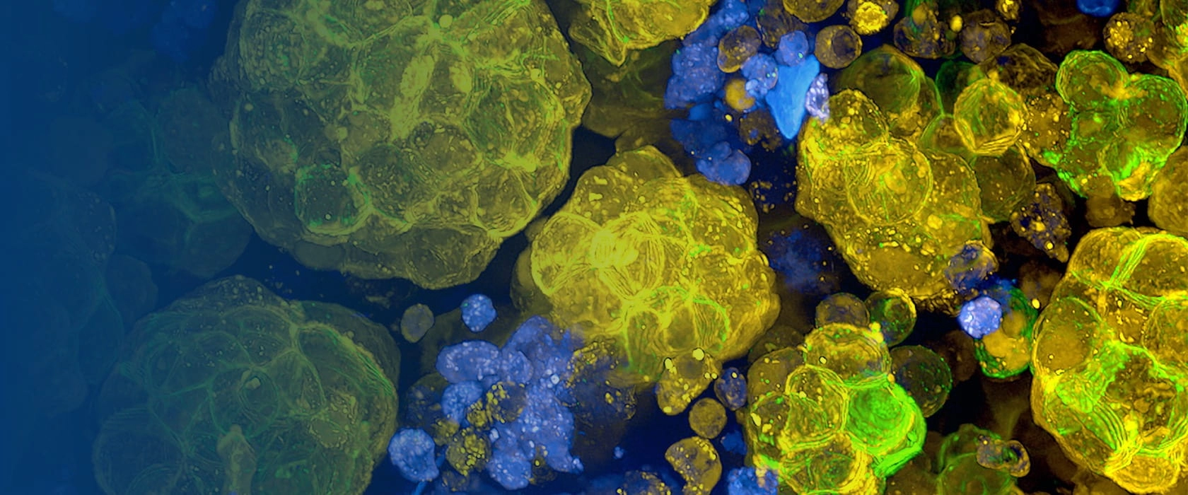 世界阿尔茨海默病日<br />如何选择AD转基因动物模型