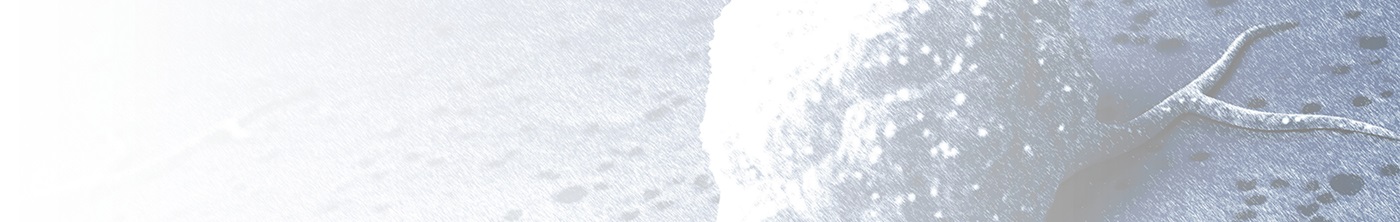 ONCO-HU<sup>&reg; </sup>模型