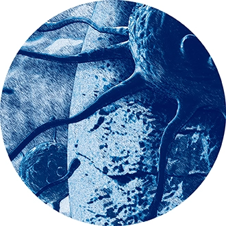 ONCO-HU<sup>®</sup>