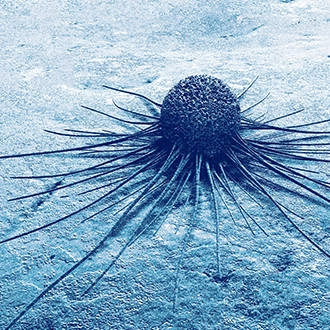 发表在 《CANCER<br> RESEARCH》上的有关肿瘤生物学数据库的新文章