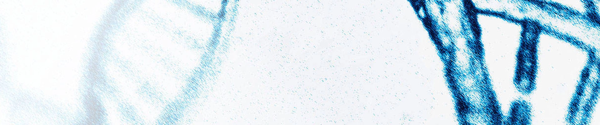 非酒精性脂肪肝炎 (NASH)