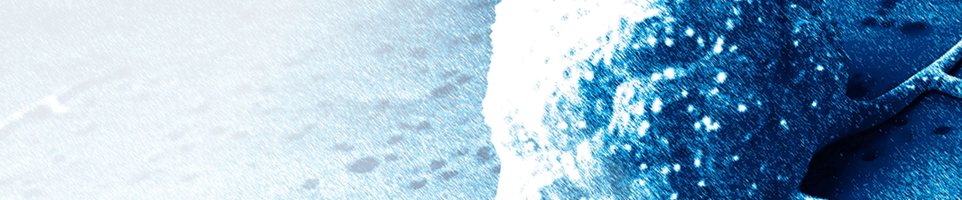 CD34+ 人源化小鼠